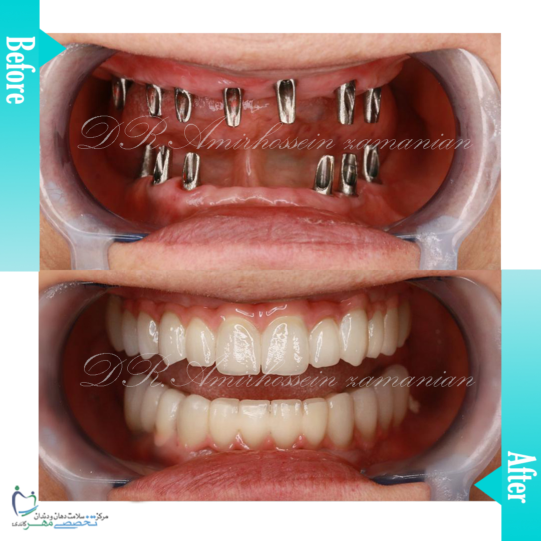 دکتر امیرحسین زمانیان متخصص پروتز های دندانی